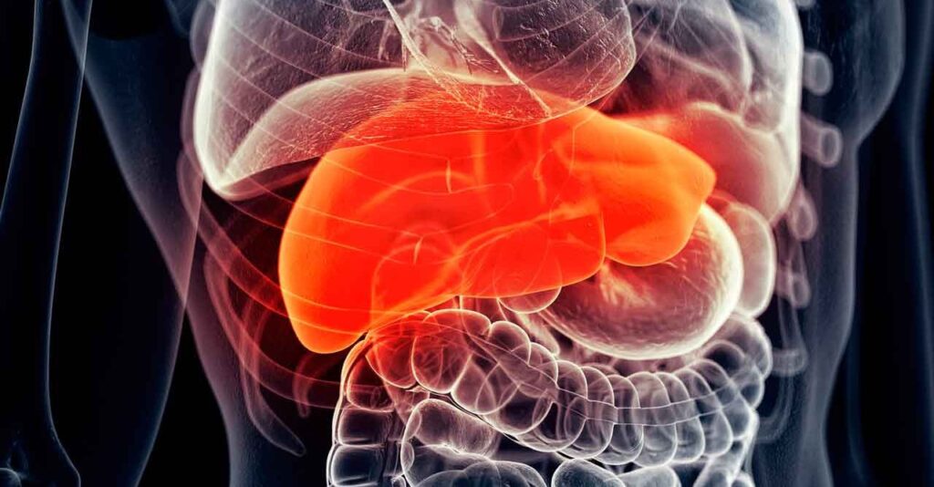 Fatty Liver Symptoms in Females